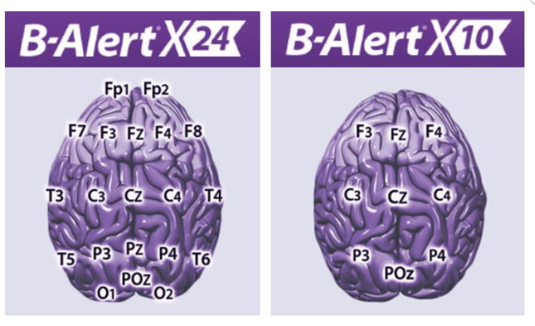 B-ALERT X10®--B-ALERT X24®